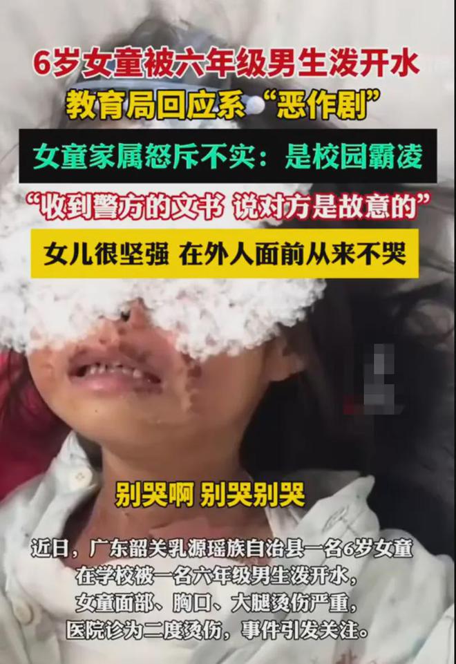 11岁少年公园泼开水致女童受伤，无需承担刑事责任