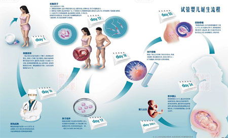 我国首例试管婴儿诞生三十年回顾与展望