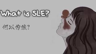 红斑狼疮揭秘，为何被称为不死的癌症