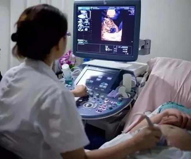 双胞胎产检正常却胎死腹中事件深度解析与医院回应科普