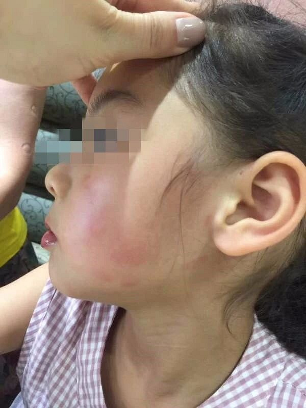 警方回应教练涉嫌暴力击打女孩脸部事件引发关注震怒！