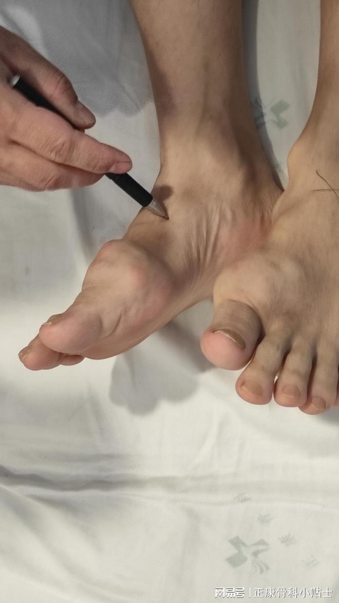 最新痛风治疗方法，自然美景之旅与内心平和的追寻