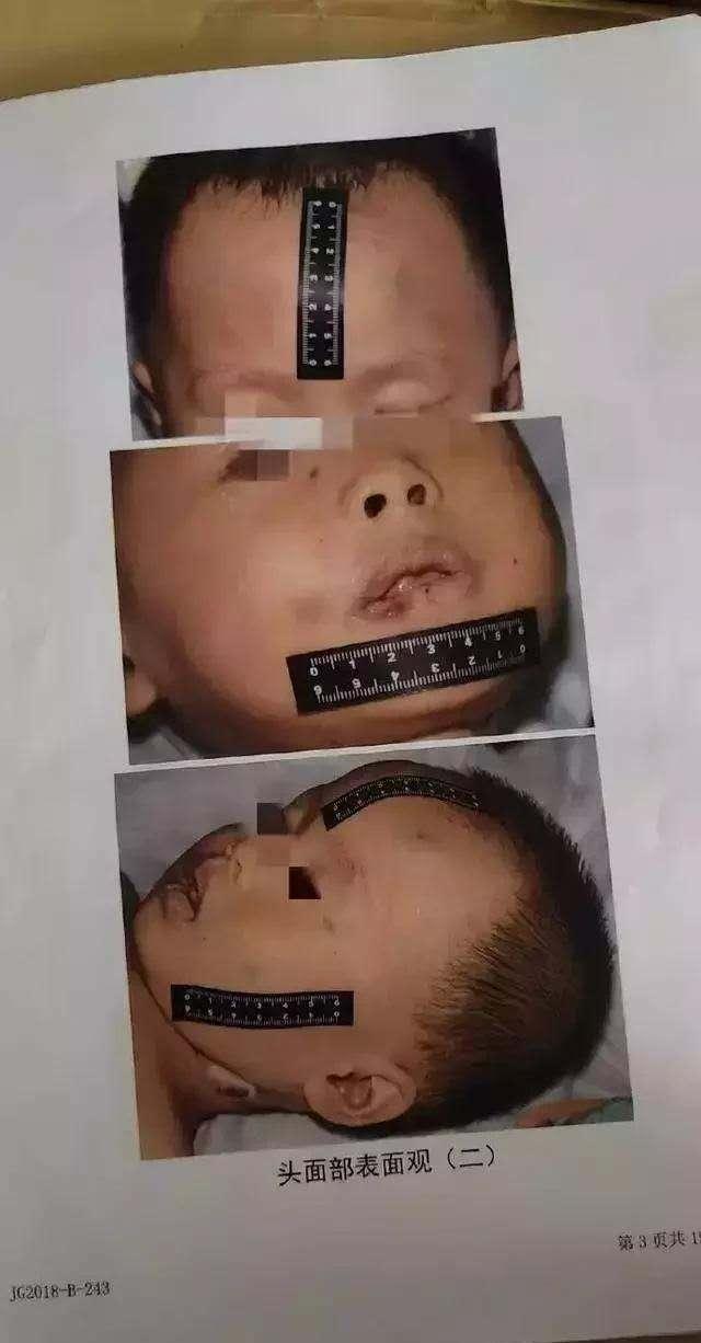 最新尸检结果详解，任务执行与技能提升指南